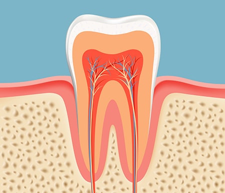 rootCanal-big
